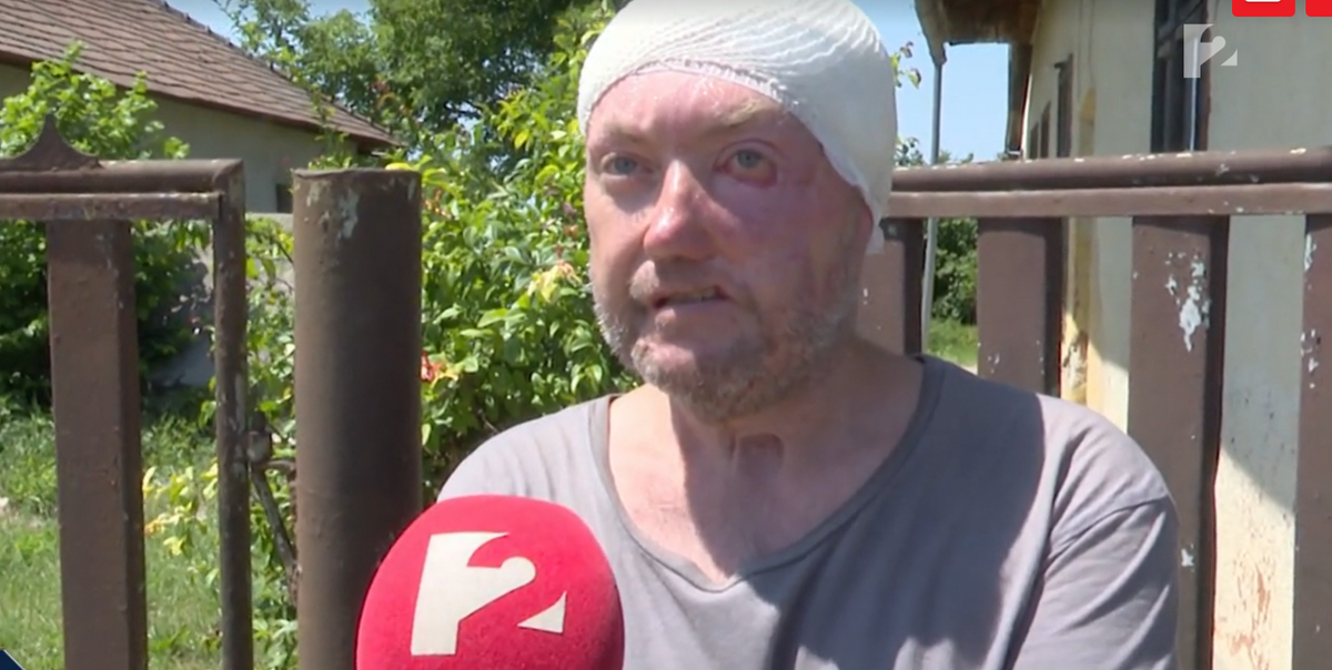 kutyatámadás Mérán