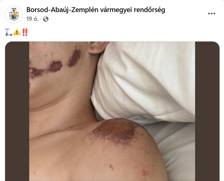 sérült