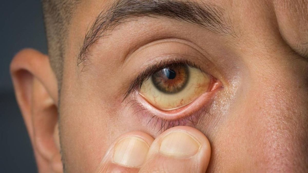 Járványveszély Borsodban?