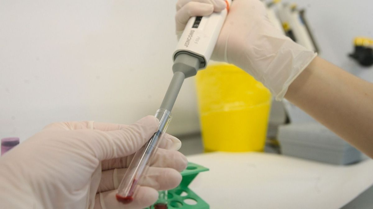 Cseppfertőzéssel terjed a gennyes agyhártyagyulladás.