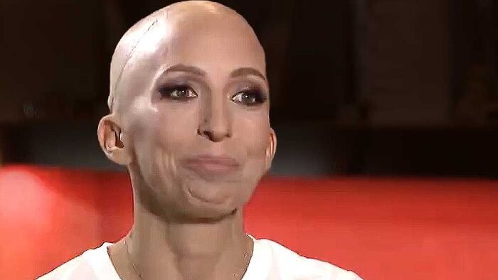 Rubint Réka rákbetegséggel küzd, paróka nélkül beszélt élete legnehezebb időszakáról – fotóval, videóval